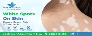 White Spots on Skin: Causes, Cancer Risk & Treatments