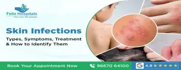 Skin Infections: Types, Symptoms, Treatment & How to Identify Them