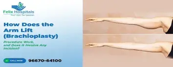 Best Hospital in Noida